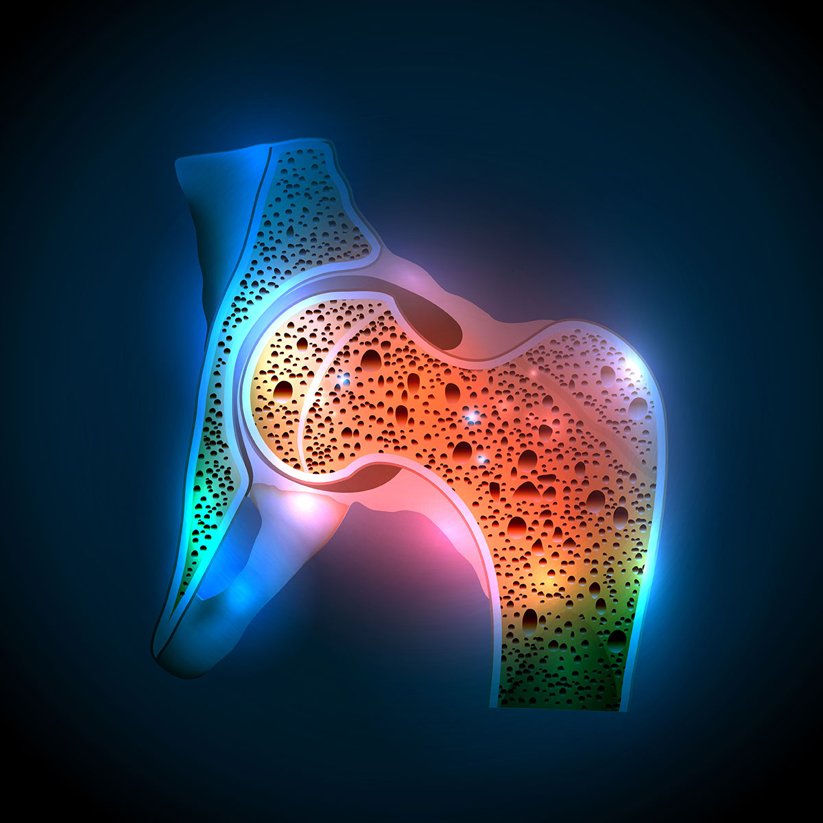 Osteoporoza w okresie menopauzy